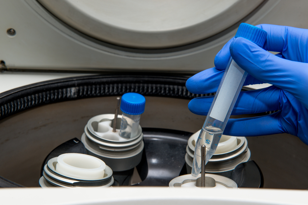 Scientist is putting a test tube into centrifuge