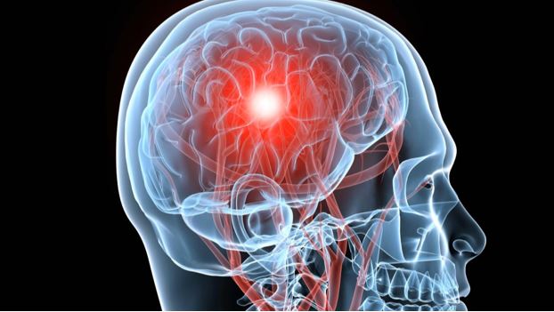 Brain scan