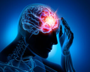 What Is A Traumatic Brain Injury?